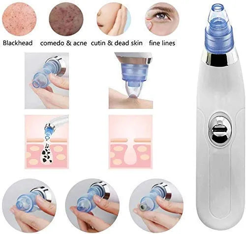 Derma Suction Blackhead Remover Machine